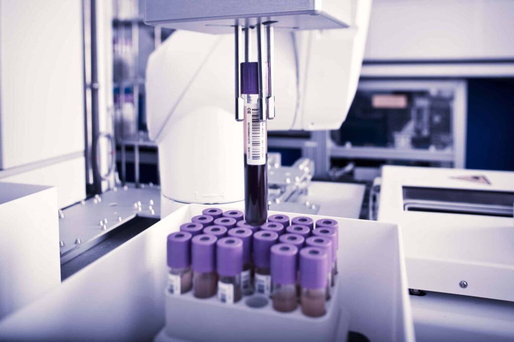 Blood sample processing