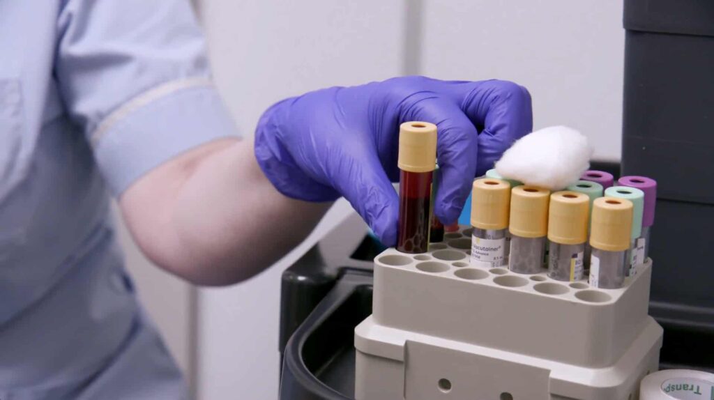 A close-up of a blood sample